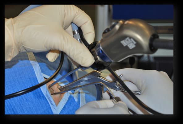 Instrumental para neuroendoscopía