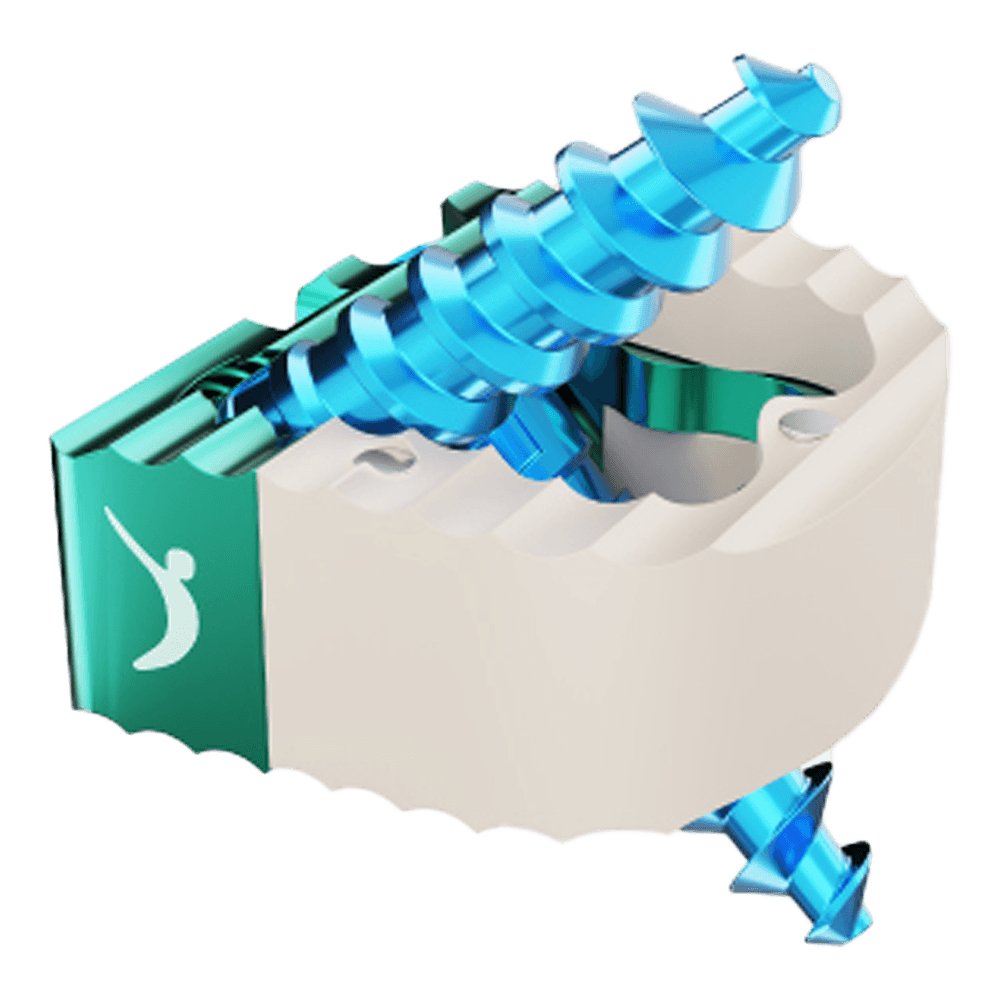 Imagen destacada de Caja Intersomática Anterior PEEK Cage Stand Alone