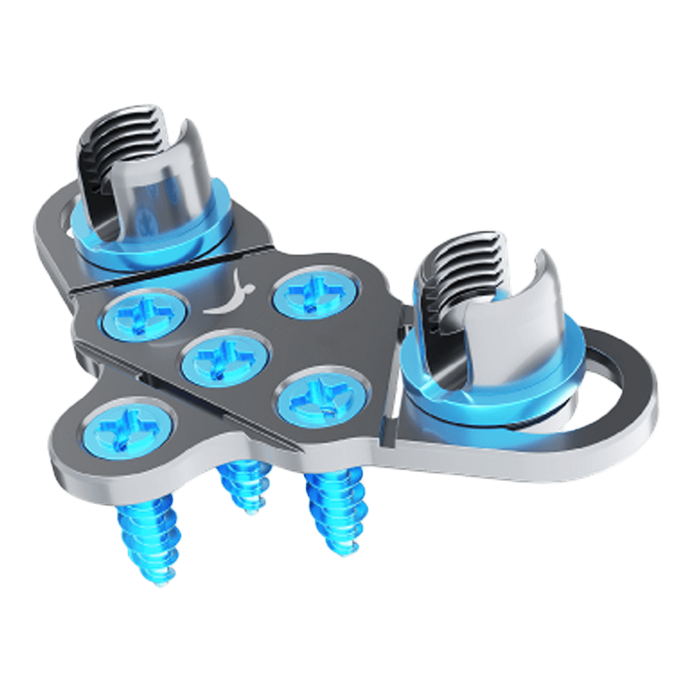 Imagen destacada de Placa Occipito Cervical