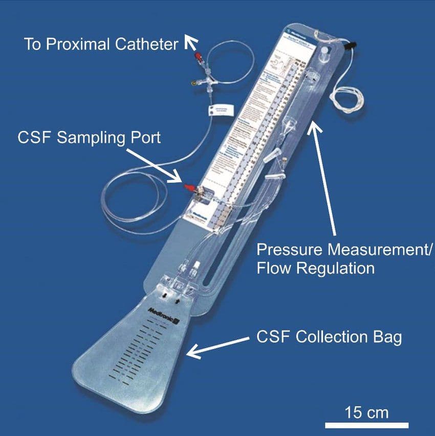 Imagen destacada de Sistema Becker EDMS